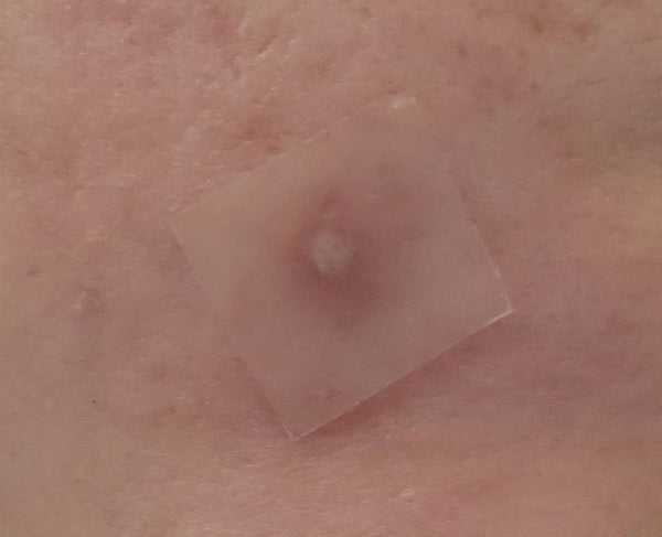 @Cherry review photo