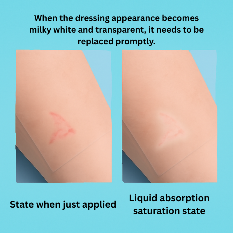 Soft Seal™ The Patch Upgrade Hydrocolloid Pimple Patch Roll